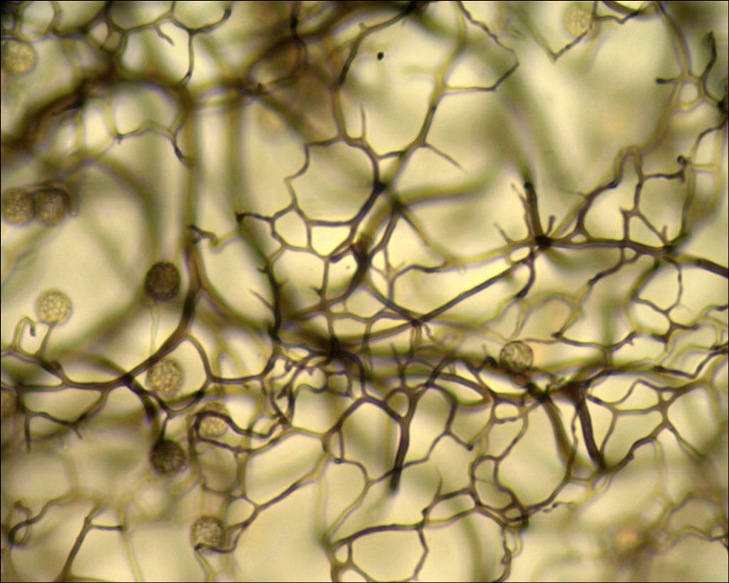 Comatricha o Stemonitopsis?